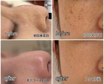 美顔アンドリラクゼーションルーム ソワン沙季