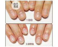アンティクイーン(Antiqueen)