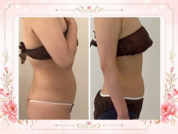リリ(RILI)/【ダイエット・バストケア】