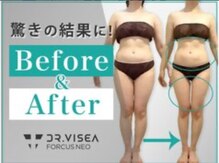 フィールファイン(feel fine)