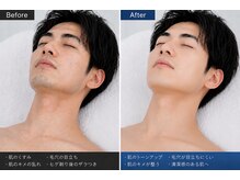 エクラ(eclat)の雰囲気（肌のトーンアップ、清潔感が出ます！）