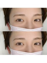 プペ(Pupe)/ラッシュリフト