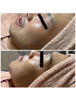 ソフィアアイズ 倉敷店(SOPHIAEYES)/【メンズ】フェイシャルWAX