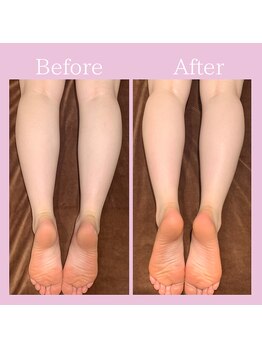 グロウ トータルビューティデザイン(GLOW TOTAL BEAUTY DESIGN)/角質ケア