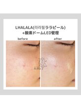 ポムハヌル(pom.haneul)/韓国肌管理室