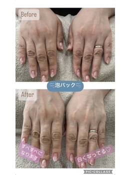 シーオングル(Siii ongle)/