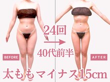 べモーレ 上本町 谷町九丁目(Bemolle)/40代痩身24回ビフォーアフター☆
