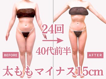べモーレ 上本町 谷町九丁目(Bemolle)/40代痩身24回ビフォーアフター☆