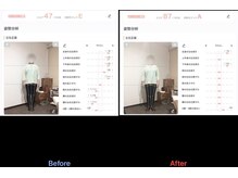 鹿児島整体院/姿勢47→87 腰痛姿勢改善
