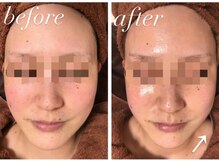 ソレラ(sorelle)/ハイパーナイフ