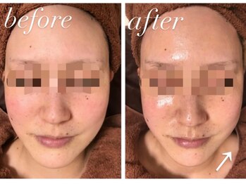 ソレラ(sorelle)/ハイパーナイフ