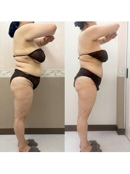 トータルサロンアイビーシー(トータルサロンIBC)の写真/ハイパーナイフコンテスト痩身部門準優勝スタッフ在籍の本格サロン。貴女の身体に合せたオーダーメイド施術