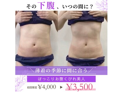 米子美人の写真