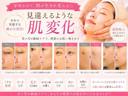 イーズ(ease)の写真