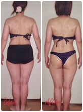 ダイエットルーム リ ボーヌ(Re Bornu)/・40代　全身メディセル16回