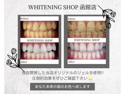 ホワイトニングショップ 函館店(Whitening Shop)の写真