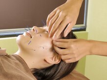 井荻癒し鍼灸院/美容鍼