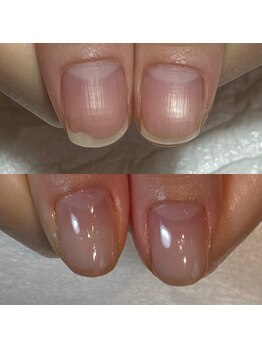 キュア(Cure.)/医師のお仕事のお客様ネイル