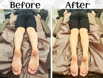 リストアハート(Restore Heart)/骨盤矯正