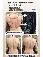 ワンバイゼロ(One by zero)/【トーンヌール】肌で飲む漢方