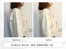 レッド(RED)/猫背矯正・骨盤矯正