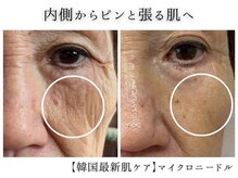 レジュイール(Rejouir)