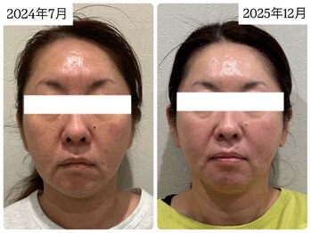 マカオン(machaon)/