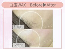 クイーンズチャーム(Queen's Charm)/バストケア★右のみ施術