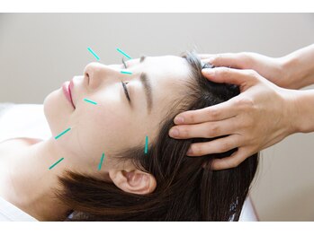 アイメディカル鍼灸整骨院の写真/年齢を重ねるごとに気になるお悩みに◎身体の内側から綺麗になれる美容法★美容鍼ですっきり小顔をGET！