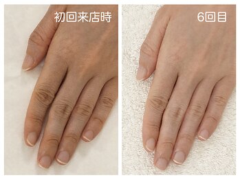 キレイテ 上野店/40代/6回目【ハンドケア上野】