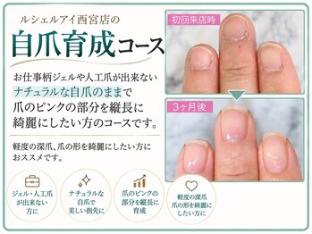 【深爪矯正・自爪育成】専門ネイルサロン ルシェルアイ 西宮店の写真/【深爪矯正・自爪育成専門店】長年の深爪・噛み爪・チビ爪・むしり爪でお悩みの方へ