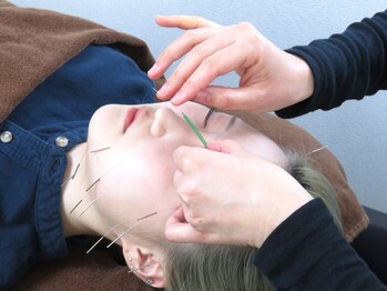 ケア リンクからだサポート鍼灸指圧整骨院/美容鍼灸【新所沢・整骨院