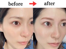 ジョリー(JOLi)/眉毛ワックス×まつげパーマ