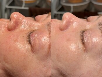 ルーナジェーナ(Luna llena)/池袋 エステ ルーナジェーナ