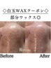 【お忙しい方、気になる部分だけ試したい方】部分白玉ワックス、はじめました