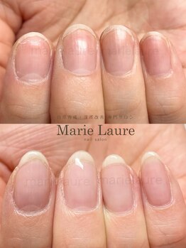 マリーロール 天王寺店(Marie Laure)/深爪矯正/自爪育成/ネイルケア/