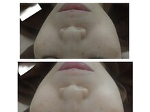 アイビーコスメティクス ディーコム(IVY.cosmetics Dcom)/ハンドマッサージ♪