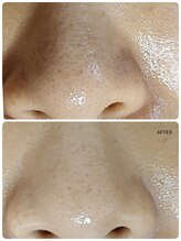 プライベートサロン 美月/