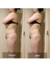 ココカラ(COCOKARA)/インディバ/アロマ　痩せ