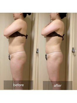 ココカラ(COCOKARA)/インディバ/アロマ　痩せ