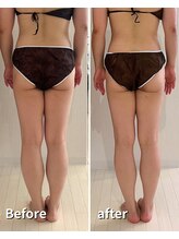 ヒールプラス(heal+)/1ヶ月通っていただきました