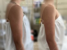 アンド ミヨン(And Miyon)/サーモシェイプオーパス20回