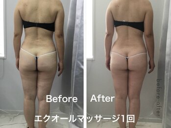 マッチ(much)/更年期のためのダイエット