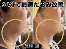 エバーグリーン(Evergreen)