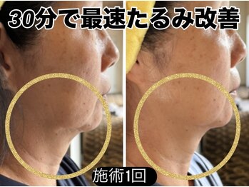 エバーグリーン(Evergreen)