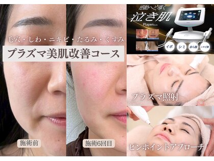 ハナ チュチュ(Hana chuchu)の写真