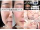 ハナ チュチュ(Hana chuchu)の写真