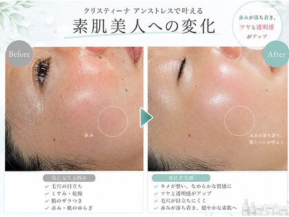 アイノア(ainoa)の写真
