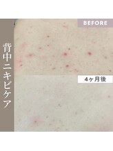 サードプレイス(3rd Place)/2階：エステ症例