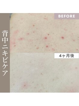 サードプレイス(3rd Place)/2階：エステ症例